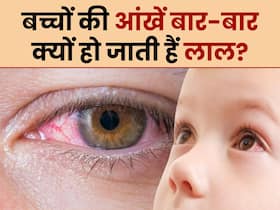 इन 5 कारणों से बच्चों की आंखें बार-बार हो रही हैं लाल, रोशनी जाने से पहले कराएं जांच