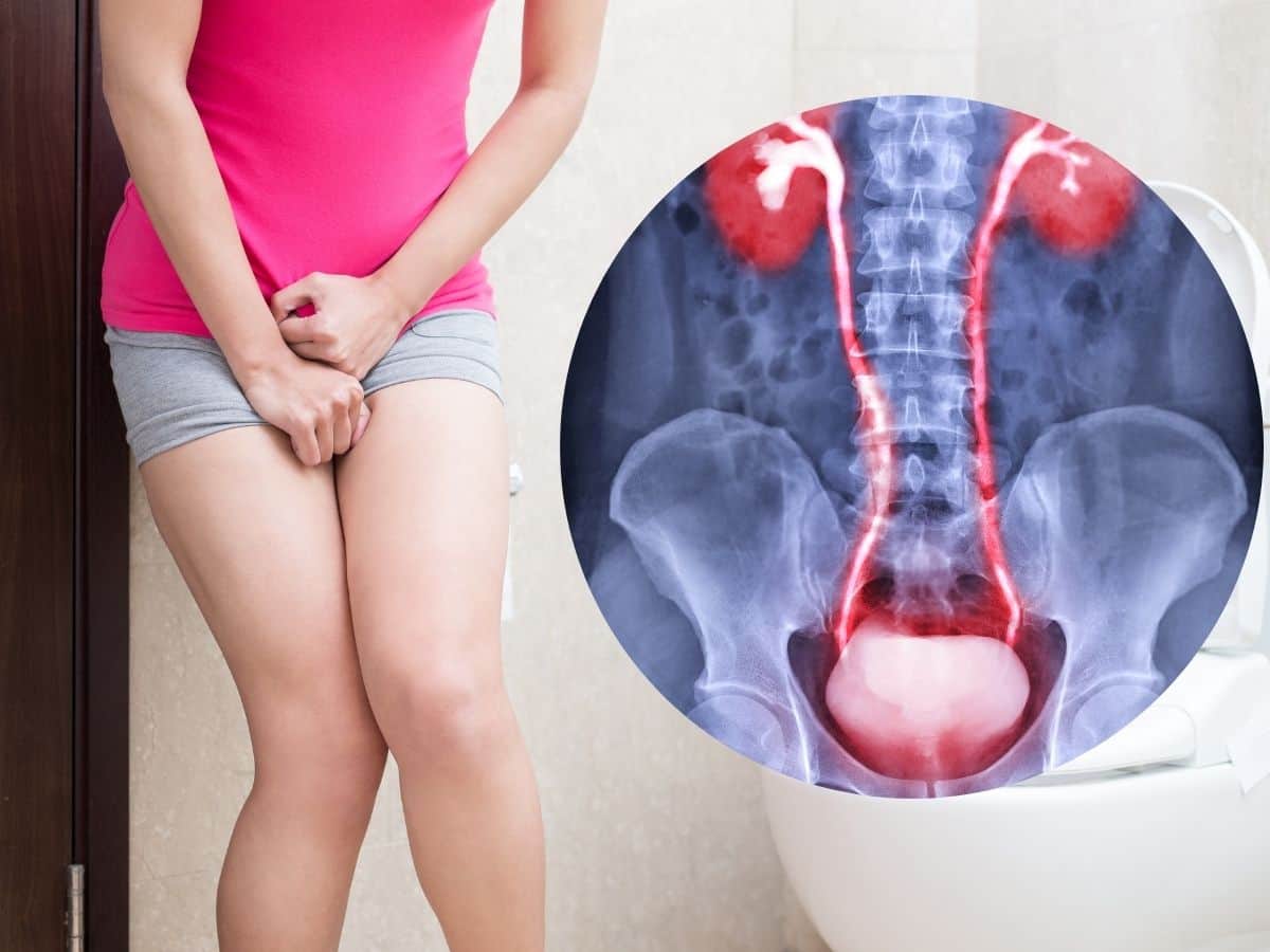 Diabetes Induced UTI Symptoms: How High Blood Sugar Levels Leads To Urinary Tract Infection In Women