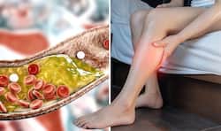 Cholesterol Inside Heart Arteries: 7 Warning Symptoms of Heart Blockage In Legs And Feet At Night