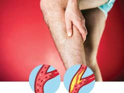 आर्टरी ब्लॉकेज होने पर पैरों के आसपास दिखते हैं ये 5 लक्षण, इग्नोर करने की न करें भूल