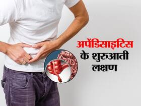 करवाने जा रहे हैं अपेंडिक्स का ऑपरेशन तो कुछ सामान्य बातों की जानकारी होना है जरूरी