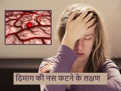 क्या है दिमाग की नस फटना और उससे पहले ही देखा जा सकता है ये खास लक्षण जो बचा सकता है जान