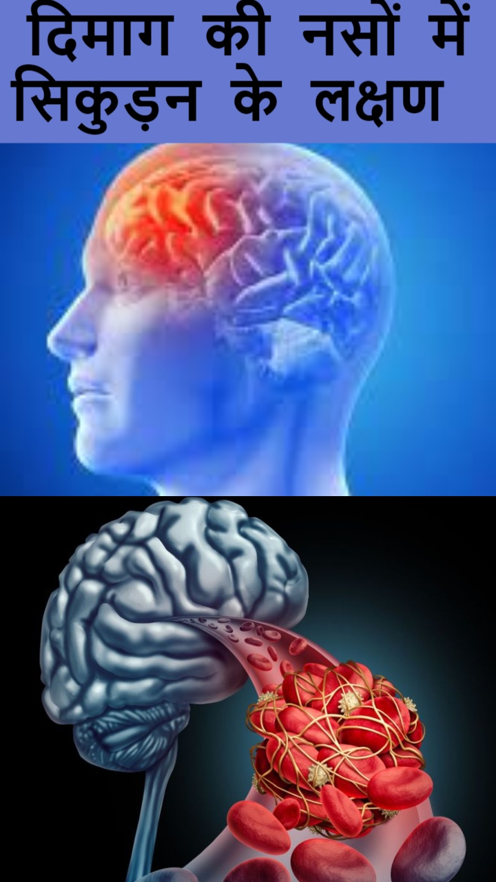 рджрд┐рдорд╛рдЧ рдХреА рдирд╕ рд╕рд┐рдХреБрдбрд╝рдиреЗ рдкрд░ рд╢рд░реАрд░ рдореЗрдВ рджрд┐рдЦрддреЗ рд╣реИрдВ рдпреЗ 7 рдмрджрд▓рд╛рд╡