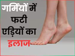गर्मियों में फटने लगी हैं पैरों की एड़ियां, तो लगाएं 5-10 रूपये में मिलने वाली ये चीजे, फूलों से सॉफ्ट बनेंगे पैर