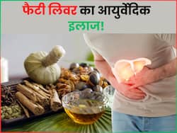 आयुर्वेद की इन 5 जड़ी-बूटियों से करें फैटी लिवर का इलाज, कुछ ही दिनों में जमा चर्बी होगी कम