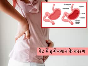 इन 4 साधारण कारणों से भी हो सकता है पेट में इन्फेक्शन जो बाद में बन सकता है गैस्ट्राइटिस, इग्नोर न करें ये लक्षण