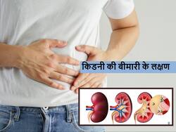 ज्यादातर लोगों में साधारण दिखने वाले ये 5 लक्षण हो सकते हैं किडनी डैमेज का संकेत, आप भी रहें सावधान