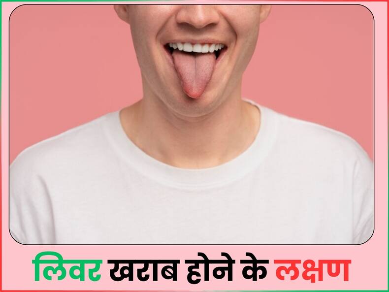 जीभ पर दिखें ये 4 लक्षण तो हो जाएं सावधान, हो सकते हैं लिवर खराब होने के संकेत