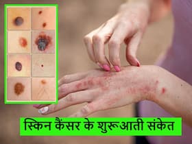 स्किन पर आसानी से दिख जाते कैंसर के ये लक्षण, एक्सपर्ट्स ने बताया कैसे करें इनकी पहचान