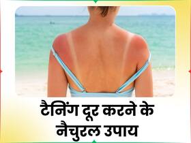 छोड़ दें अब सनबर्न की टेंशन, आयुर्वेद के ये हर्बल प्रोडक्ट्स आपको देंगे तुरंत राहत