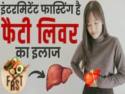 Fatty Liver Treatment: इंटरमिटेंट फास्टिंग से होगा फैटी लिवर का इलाज!