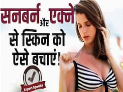 Sunburn Acne Remedies: गर्मियों में एक्ने और सनबर्न से बचने का आसान तरीका!