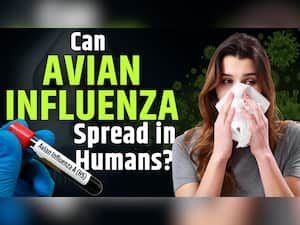 Influenza A Virus: A Highly Contagious Viral Infection