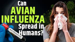 Influenza A Virus: A Highly Contagious Viral Infection