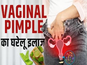 Vaginal Pimple Remedies: वजाइनल में पिंपल का ये है घरेलू इलाज
