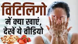 Vitiligo Diet: विटिलिगो के लक्षणों को ऐसे करें कम! डाइट में शामिल करें ये चीजें