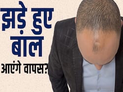 Men's Hair Regrowth: पुरुषों में ये है कारण बाल झड़ने का, ऐसे उगेंगे नए बाल