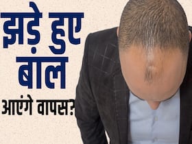 Men's Hair Regrowth: पुरुषों में ये है कारण बाल झड़ने का, ऐसे उगेंगे नए बाल