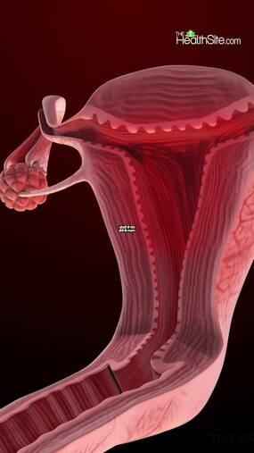 Ovarian Cyst Symptoms Ovarian Cyst Symptoms
