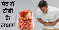 पेट में टीबी होने पर दिखते हैं ये 5 शुरुआती लक्षण, 90 फीसदी लोग साधारण समझकर करते हैं इग्नोर
