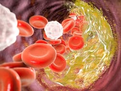 सुबह बासी मुंह इन 2 पत्तों को चबाने से नसों में चिपका कोलेस्ट्रॉल होगा बाहर, हार्ट अटैक का खतरा भी होगा कम