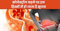शरीर के इन 4 हिस्सों में सूजन से समझ जाएं बढ़ चुका है खराब कोलेस्ट्रॉल, तुरंत कराएं जांच