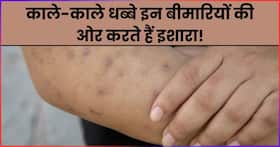 स्किन पर काले-काले धब्बे इन 5 बीमारियों की ओर देते हैं संकेत, इग्नोर करने की न करें गलती