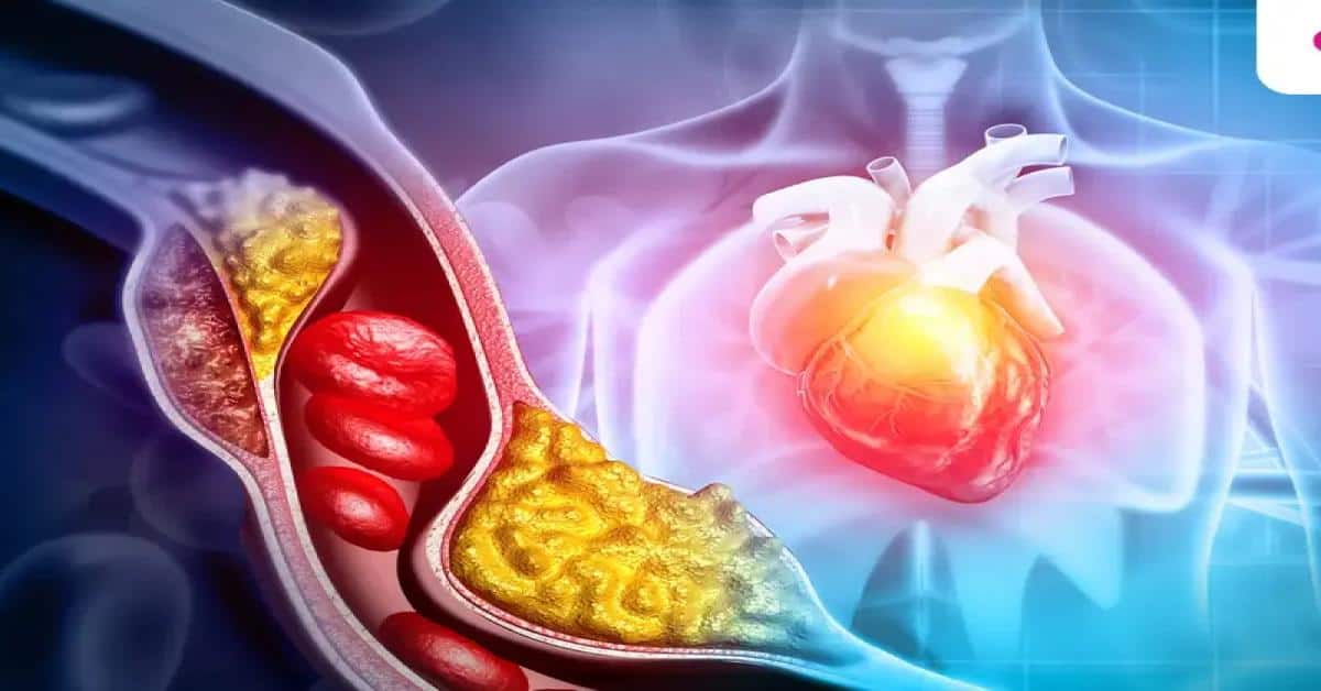 Heart Blockage Ke Lakshan शरीर में दिख रहे हैं ये 5 लक्षण तो समझ जाएं