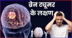 ये 7 संकेत बताते हैं कि ब्रेन में बन रहा है ट्यूमर, जानें Brain Tumor के शुरूआती लक्षण