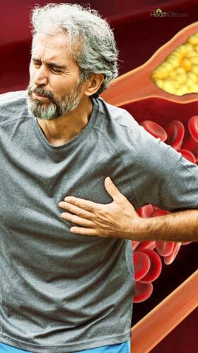 Clogged Arteries: 7 Ayurvedic Herbs To Unclog Heart Arteries Naturally Clogged Arteries: 7 Ayurvedic Herbs To Unclog Heart Arteries Naturally