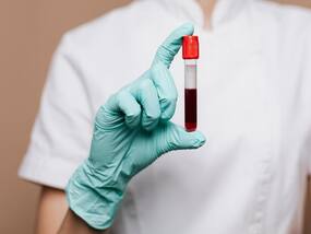 To Raise Hemoglobin Levels In The Body, Include These 5 Food Items In Your Diet