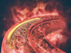 5 Ayurvedic Herbs that Increase Blood Circulation and Lower Bad Cholesterol