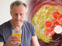 High Cholesterol Management Tips: Top 5 Yellow Summer Superfoods To Flush Out Bad LDL Cholesterol Naturally