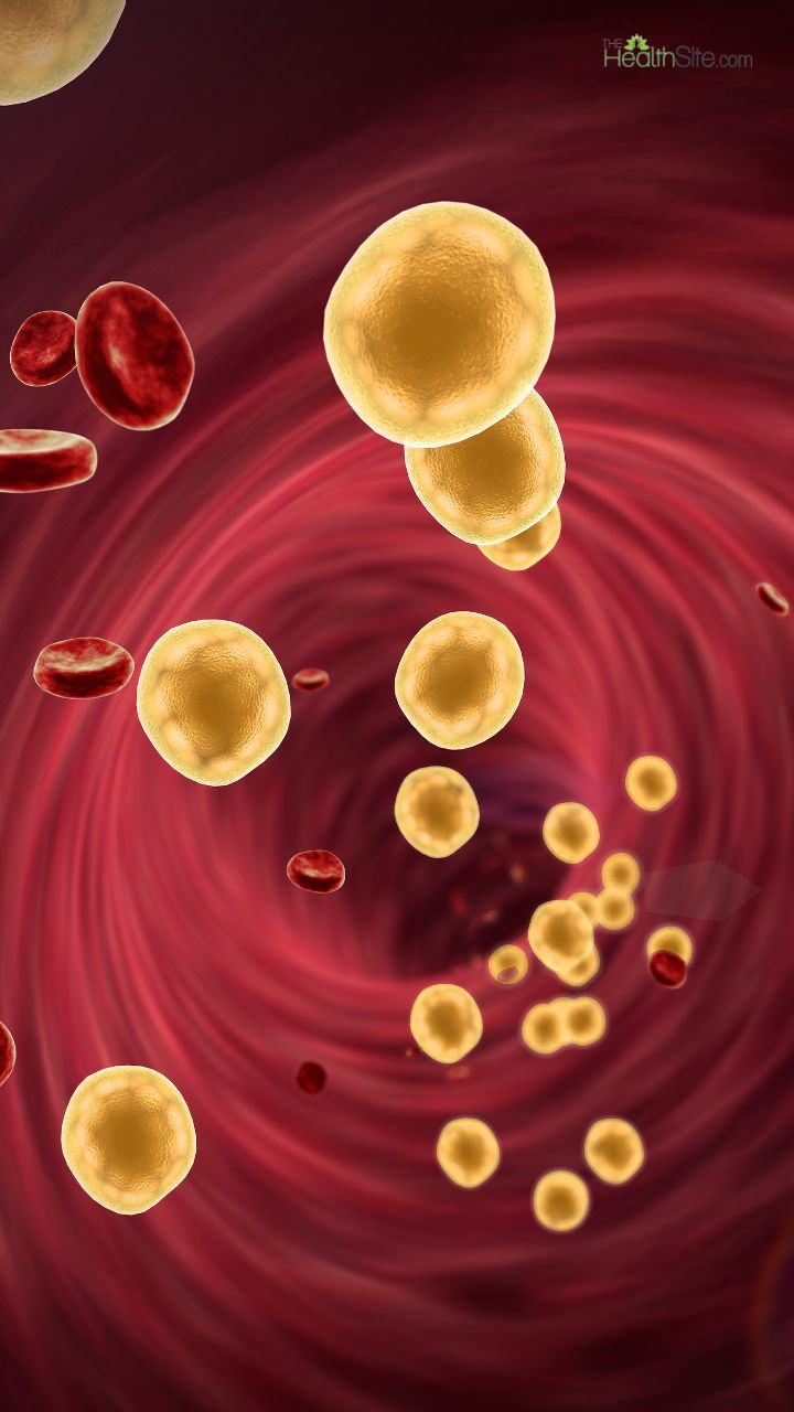 High Cholesterol: 7 Yoga Asanas To Prevent Heatstroke Due To Bad LDL Levels