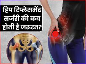 हिप रिप्लेसमेंट सर्जरी की कब पड़ती है जरूरत? जानिए कितने दिन में चलने लगता है मरीज
