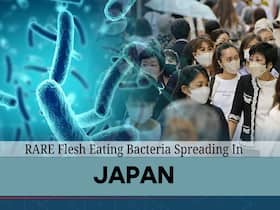 'Painful Death Within 48 Hours': Japan Sees Sharp Surge In Flesh Eating Bacteria Infection, Hong Kong Releases Advisory
