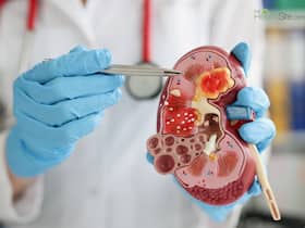 Frequent Urination To Unexplained Weight Loss: 5 Warning Symptoms of Kidney Disease