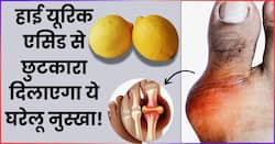 यूरिक एसिड को कम करने के लिए नींबू में मिलाकर खाएं ये चीज, पेशाब के रास्ते निकल जाएगी सारी गंदगी