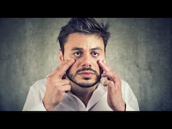 Fatty Liver Disease Symptoms: 5 Signs Of Fatty Liver Around Your Eyes