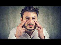 Fatty Liver Disease Symptoms: 5 Signs Of Fatty Liver Around Your Eyes