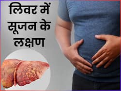 इन 6 संकेतों से समझ जाएं लिवर में हो गई है सूजन, लक्षण पहचान कर तुरंत कराएं अपना इलाज