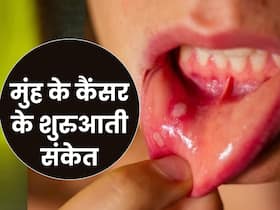 मामूली से दिखने वाले इन 8 संकेतों से समझ जाएं मुंह के कैंसर की हो चुकी है शुरुआत, 90 फीसदी लोग करते हैं इग्नोर मामूली से दिखने वाले इन 8 संकेतों से समझ जाएं मुंह के कैंसर की हो चुकी है शुरुआत, 90 फीसदी लोग करते हैं इग्नोर