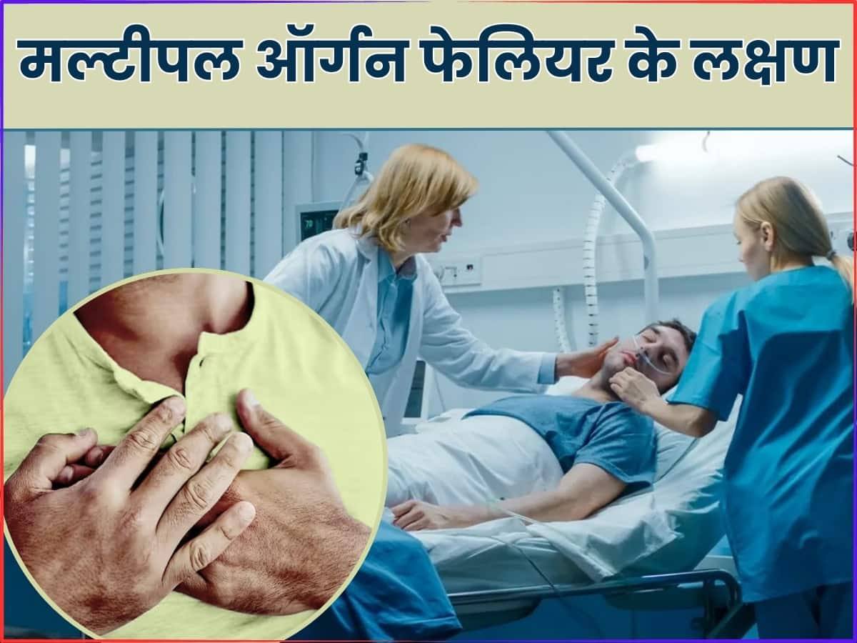 Multiple Organ Failure Ke Lakshan | Multiple Organ Failure से पहले शरीर ...