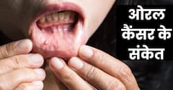 मुंह के आसपास इन 5 संकेतों से समझ जाएं गंभीर हो चुका है ओरल कैंसर, तुरंत कराएं अपनी जांच