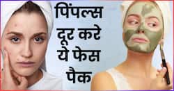 ऑयली स्किन पर पिंपल्स क्यों होते हैं? चेहरे से मुंहासों को दूर करने के लिए ट्राई करें ये 3 होममेड फेस पैक