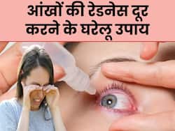 गर्मियों में आपकी आंखें भी हो जाती हैं लाल? इन घरेलू उपायों से करें इसका इलाज