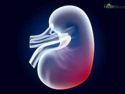 Kidney Cancer: 5 Unhealthy Practices You Must Stop Right Now To Preserve Your kidneys