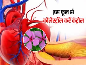 अजीब सी गंध वाला यह फूल चूस लेगा शरीर में जमा कोलेस्ट्रॉल, डायबिटीज मरीजों के लिए भी है अचूक दवा