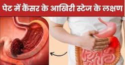 पेट में कैंसर के आखिरी स्टेज में शरीर देने लगता है ये 5 संकेत, इग्नोर करना बढ़ा सकता है मुश्किलें