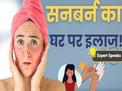 Sunburn Home Remedies: घर बैठे ऐसे करें सनबर्न का इलाज, देखें ये वीडियो